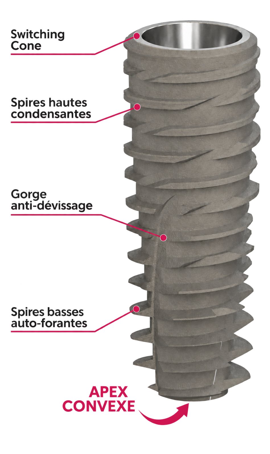 IDCAM ST — anatomie annotée : Switching Cone, spires hautes condensantes, gorge anti-dévissage, spires basses auto-forantes, apex convexe