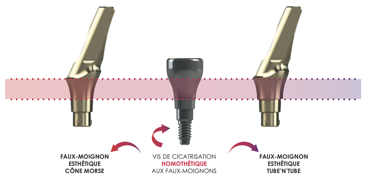 Système prothétique IDCAM — Cône Morse et Tube'n'Tube
