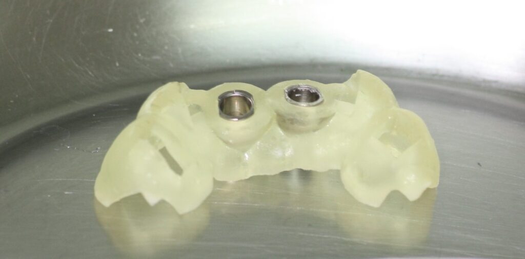 Guide chirurgical