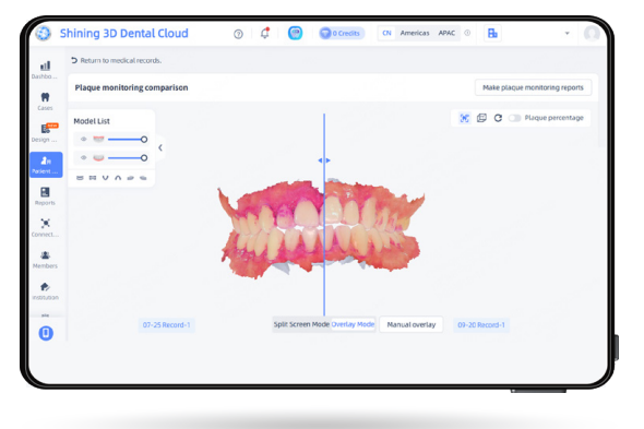 Comparaison des rapports de plaque dans Shining 3D Dental Cloud
