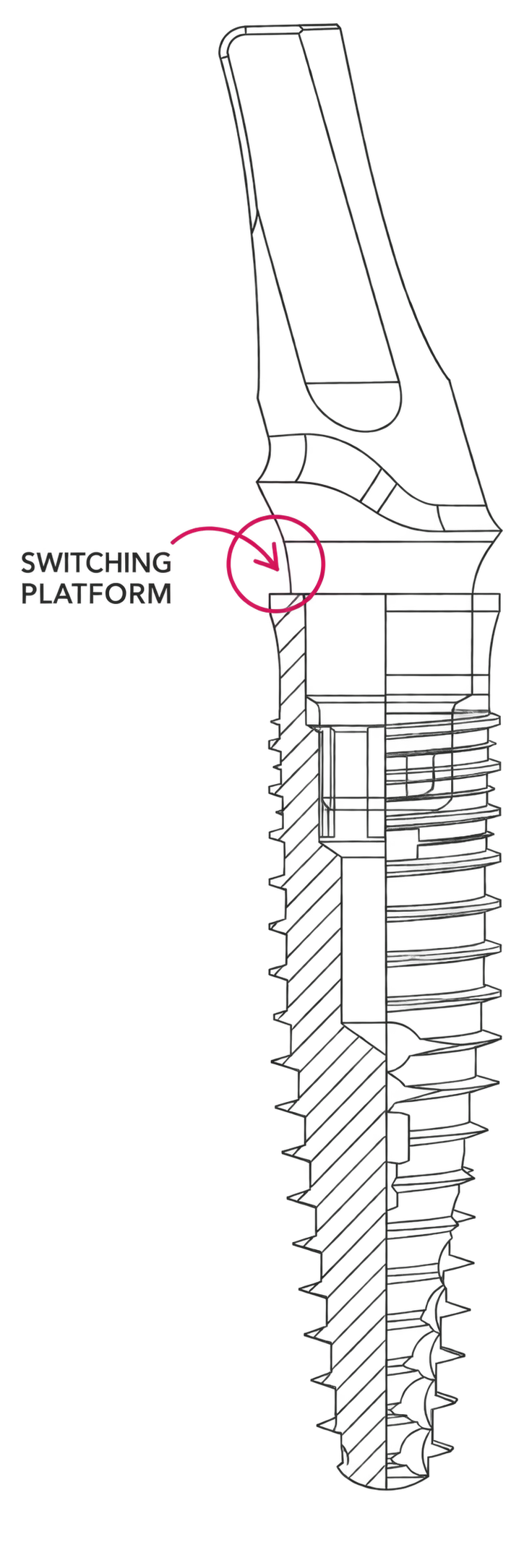 Coupe de l’implant IDALL et de son pilier montrant le platform switching